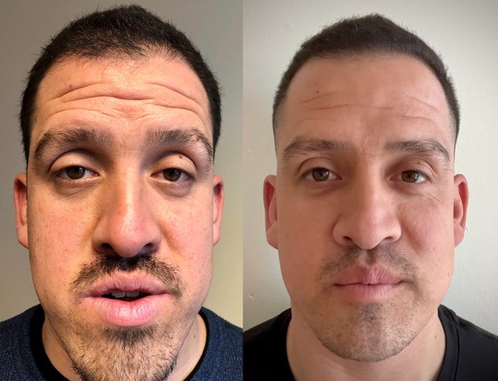 Common Abnormal Facial Growth Patterns